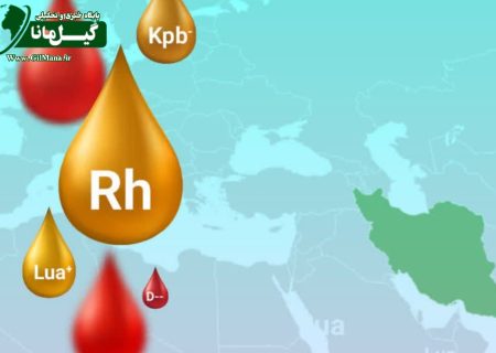 آستین بالا زدن اهداکننده خون با گروه A مثبت دارای زیرگروه خاص در تهران و گیلان